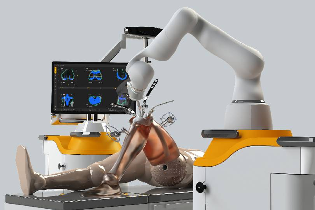 Robotic Knee Replacement Surgery