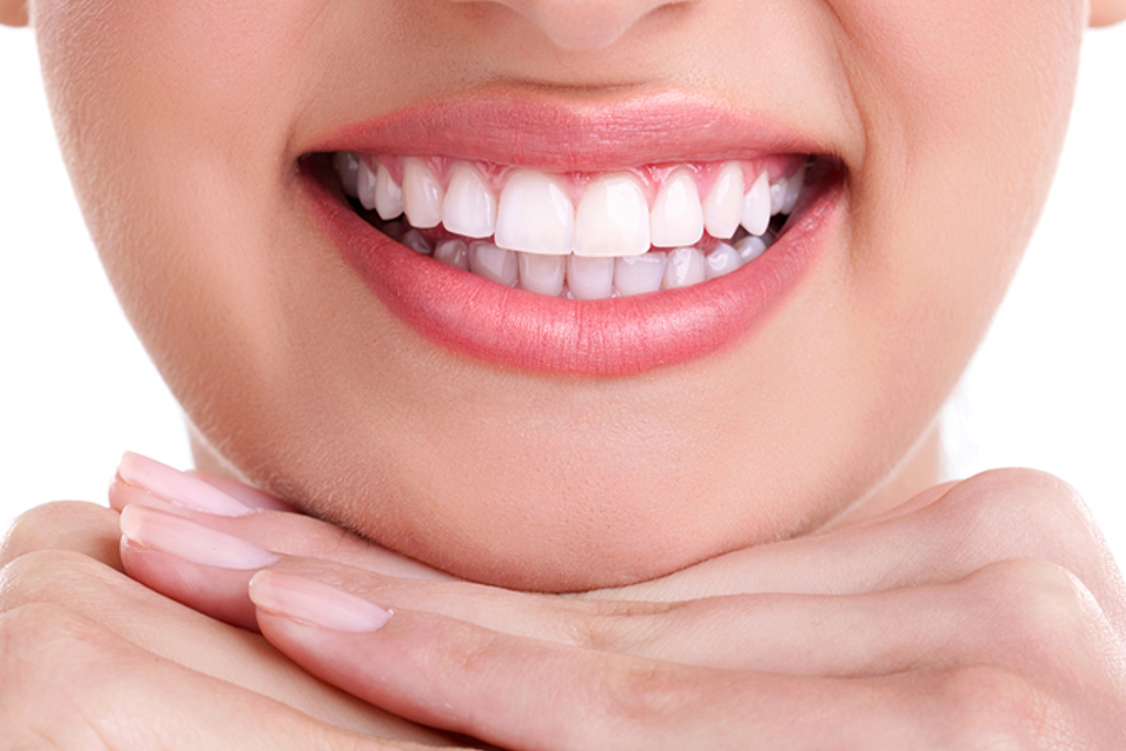 Hollywood Smile Design – Zirconium Crowns