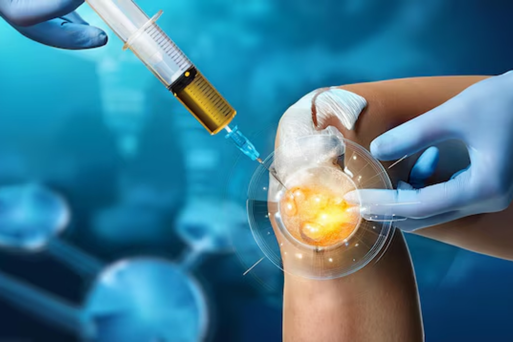 Bone Marrow Transplant (Half Match)