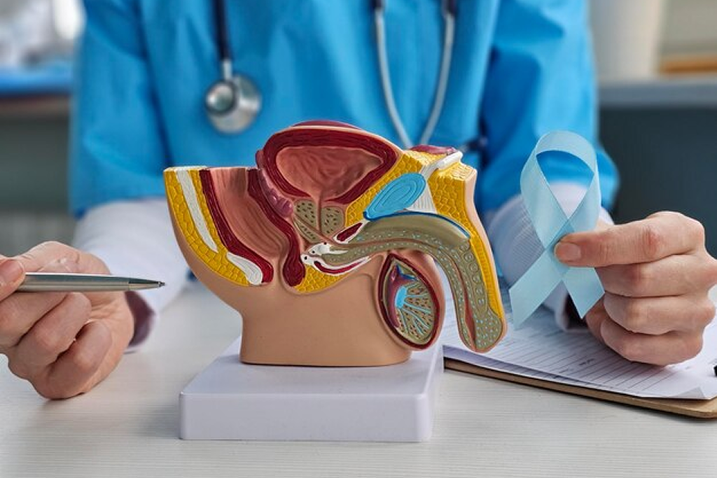 Transurethral Resection of the Prostate (TURP)
