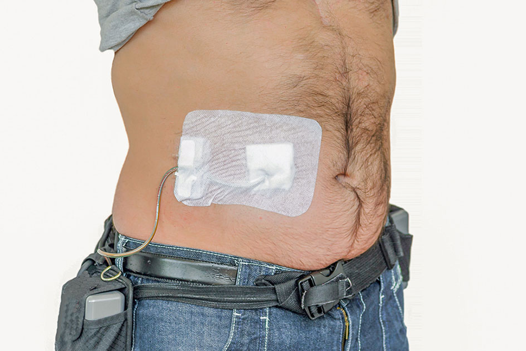 Left Ventricular Assisted Device