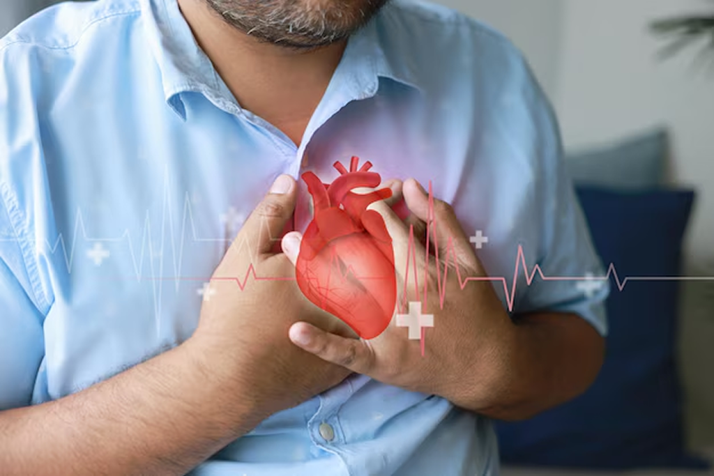 Transcatheter Aortic Valve Replacement