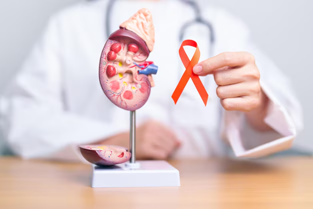 Kidney Cancer Treatment