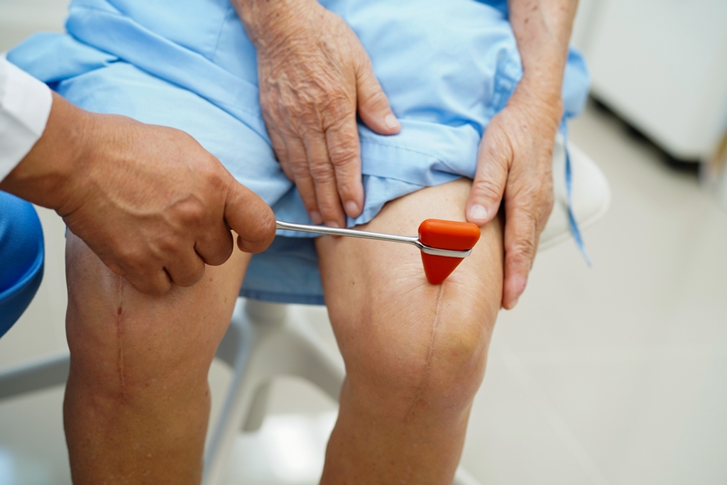 Total Knee Replacement (Bilateral)