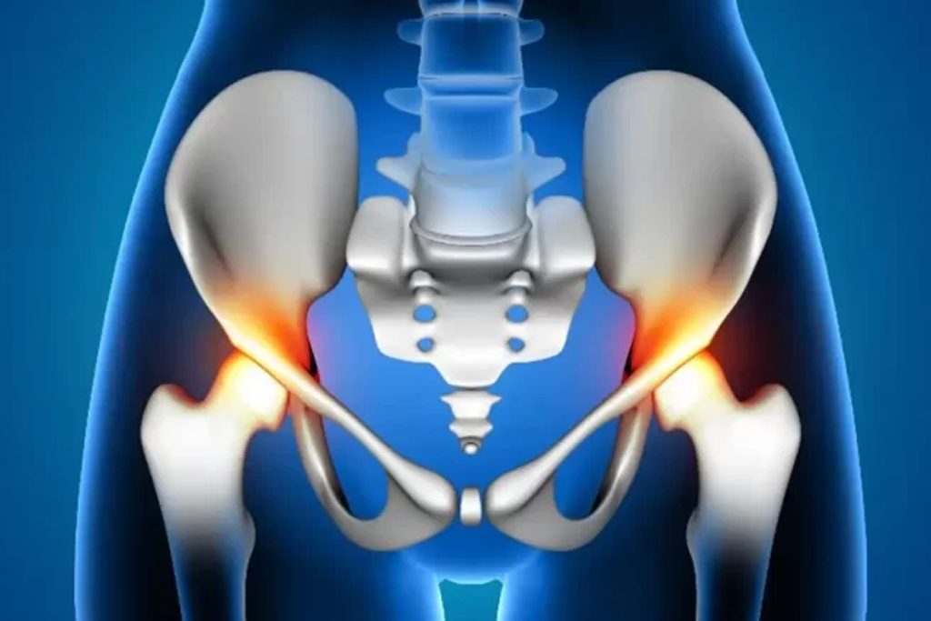 Total Hip Replacement (Bilateral)