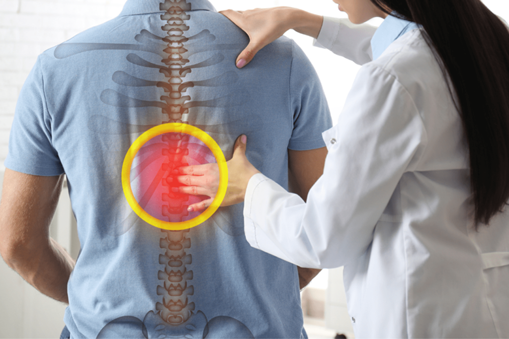 L5–S1 TLIF Surgery