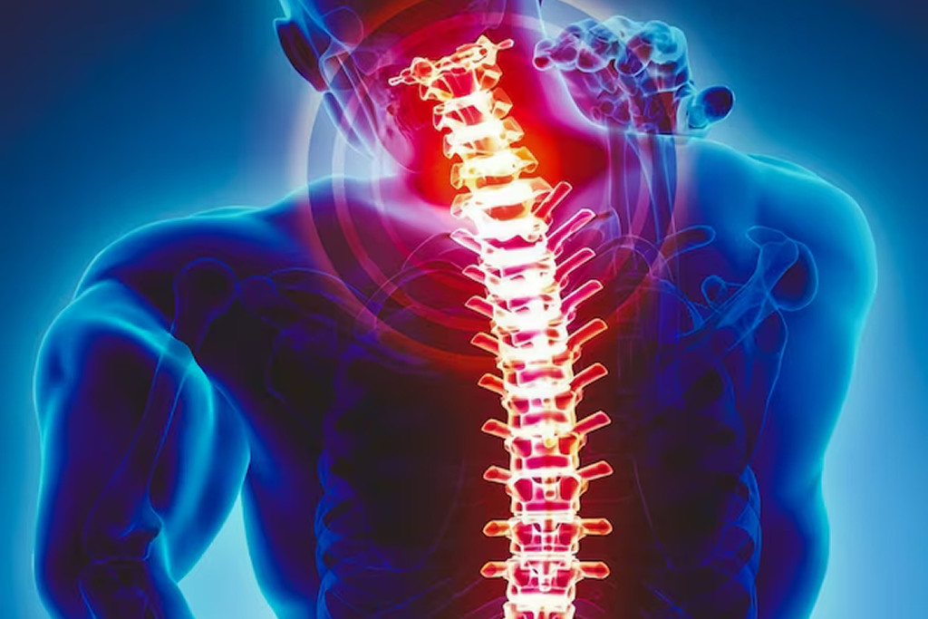 C7 Corpectomy with Fusion