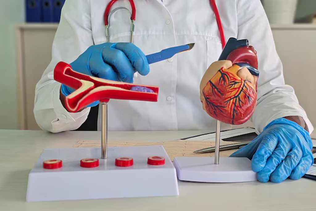 Coronary Angioplasty with 2 Stents