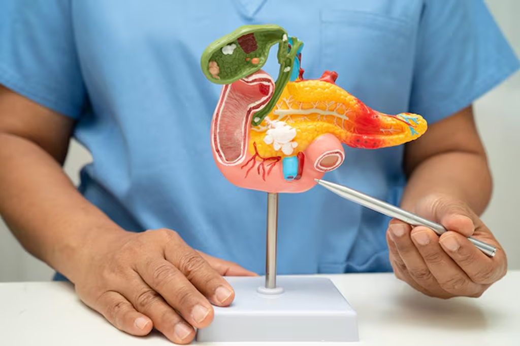 Laparoscopic Cholecystectomy