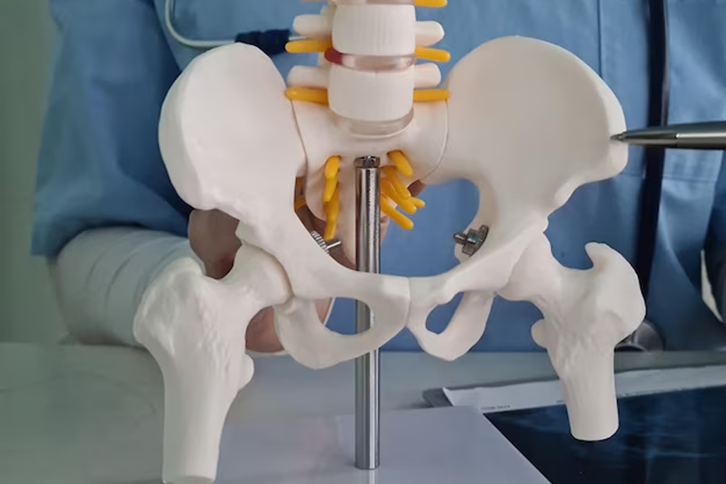 Bilateral Total Hip Replacement