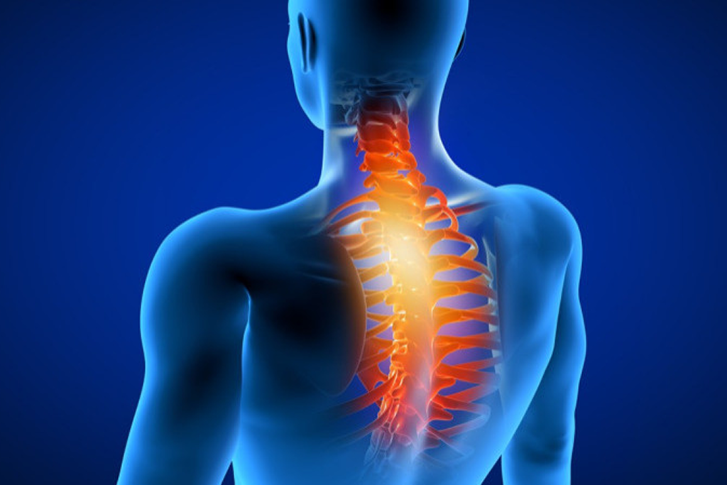 Cervical Laminectomy