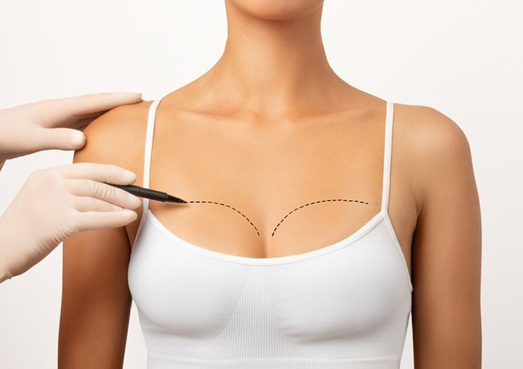 Breast Reconstruction Package in Artemis Hospital