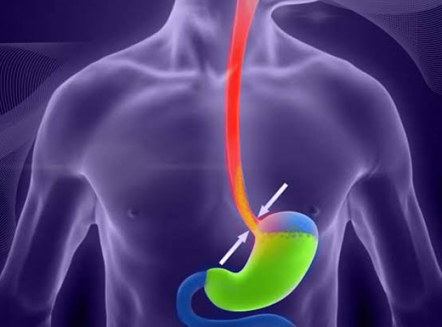 GERD x device Package in Artemis Hospital